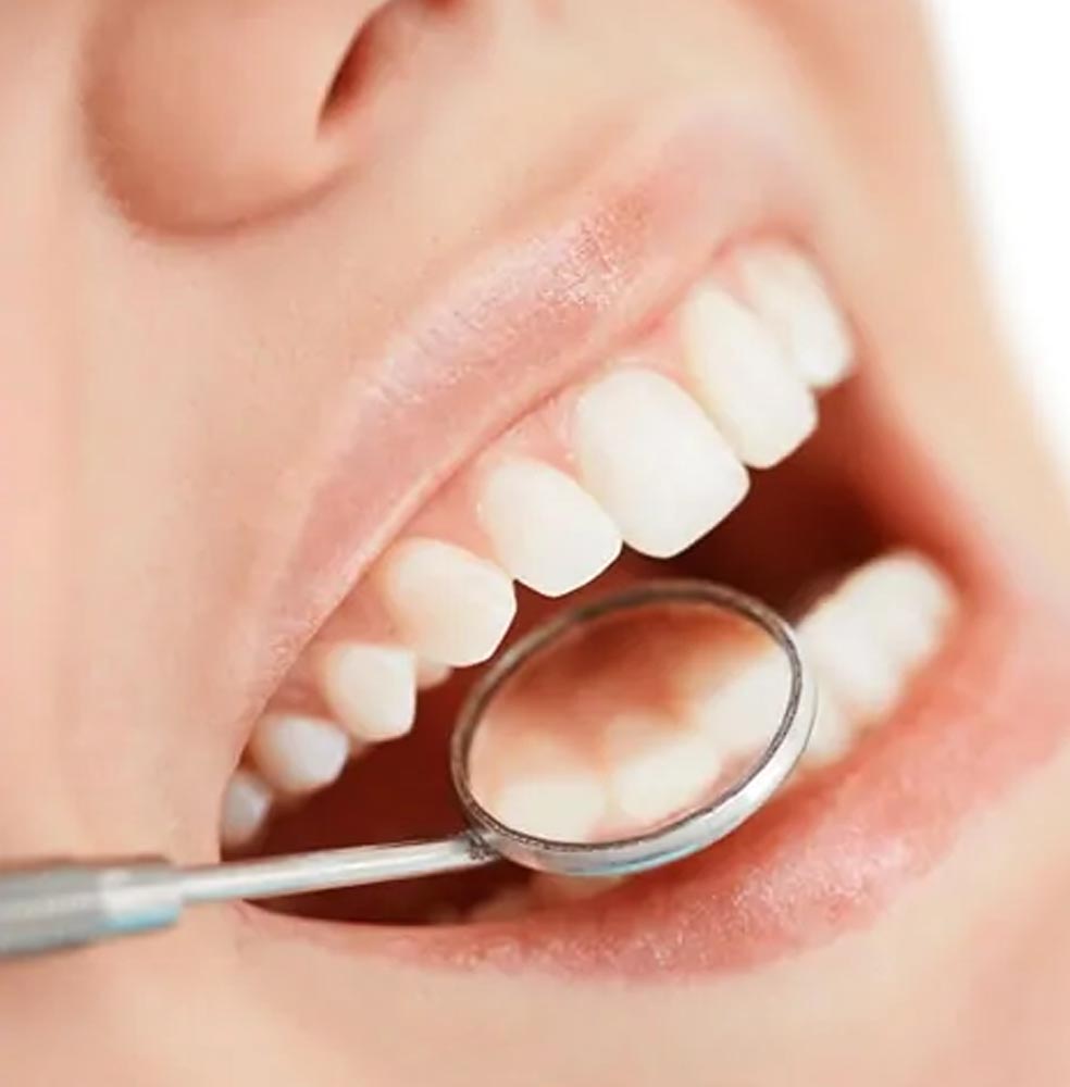 Cosmetic Dentistry