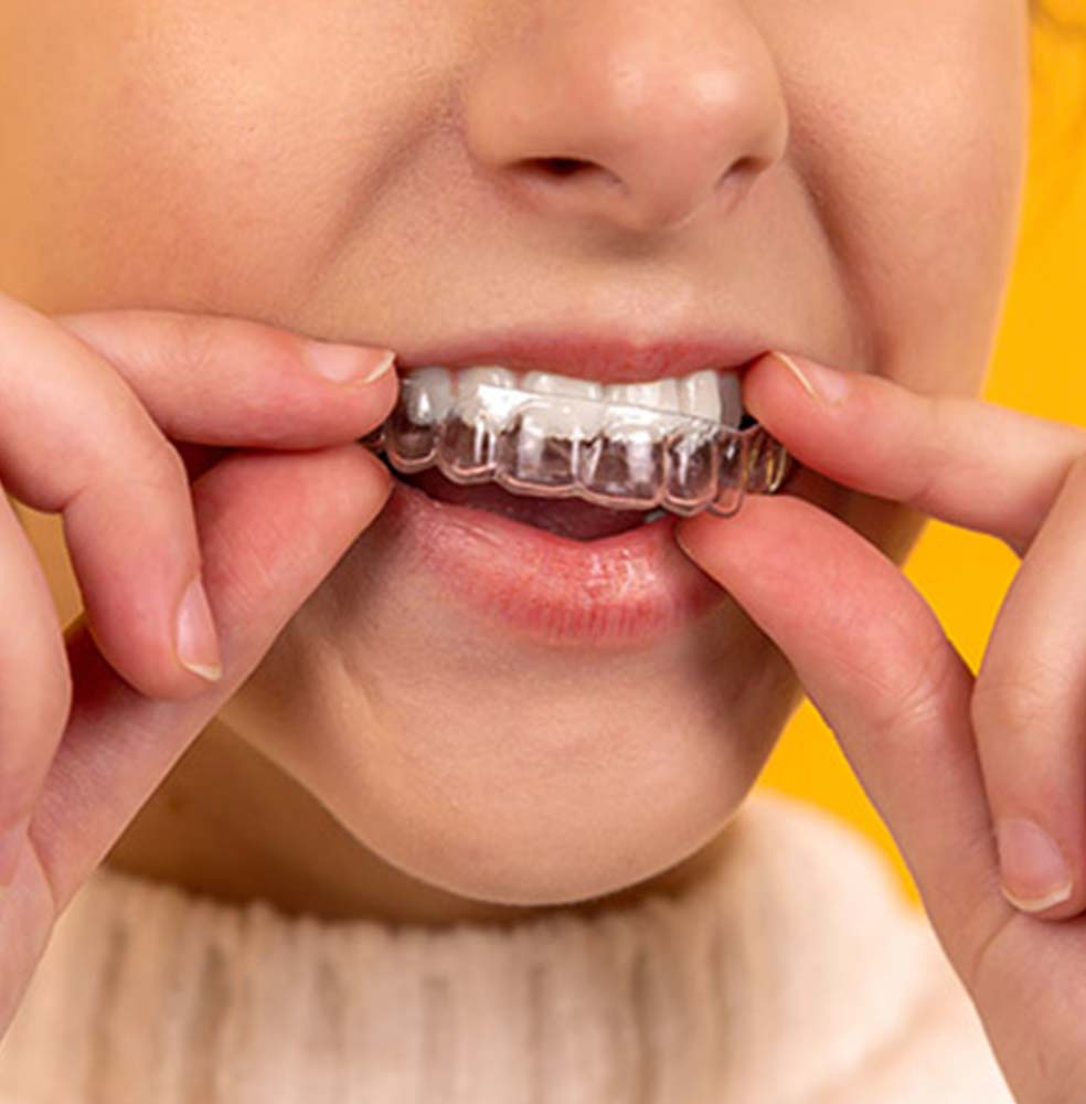 Orthodontic Treatment