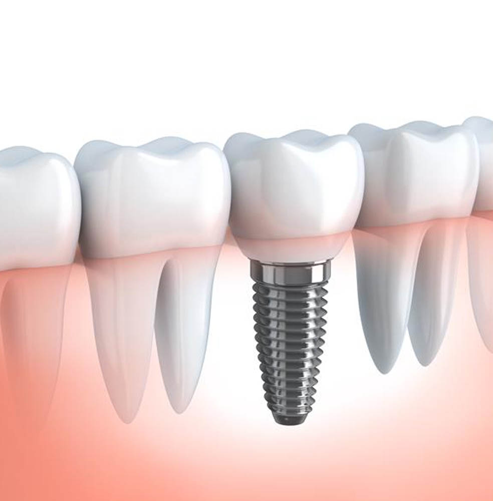 Restorative Dentistry